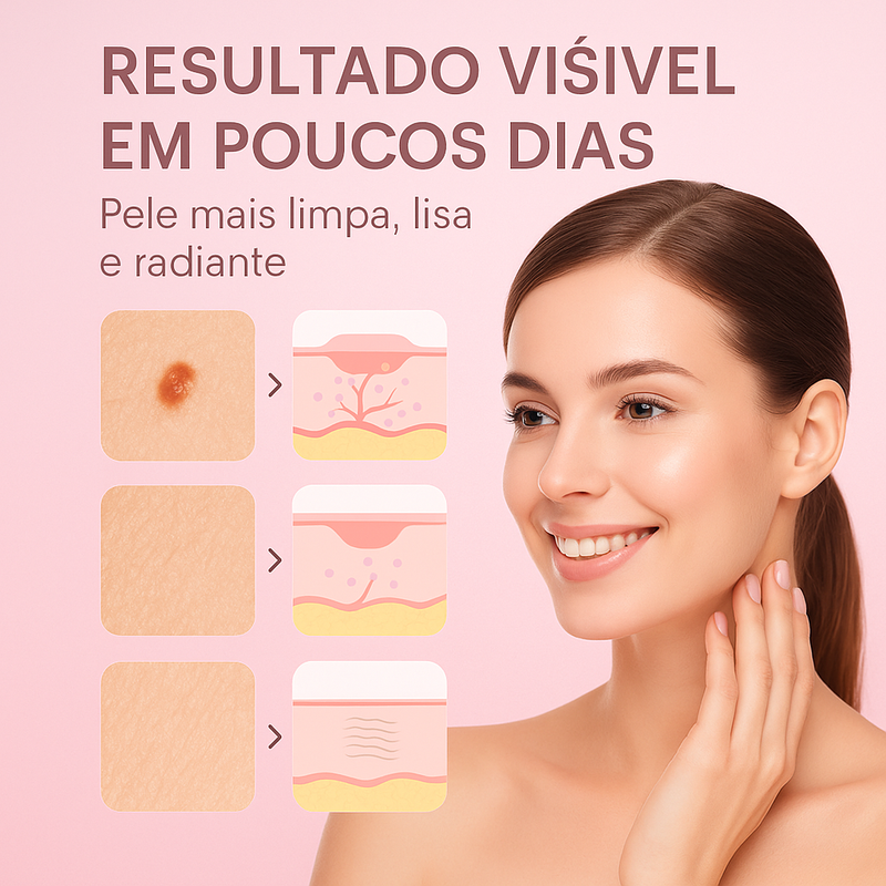 Wipe Off® - Remova Verrugas, Manchas e Marcas com Rapidez e Eficácia! COMPRE 2, LEVE 3